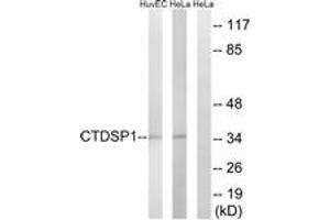 Western blot analysis of extracts from HeLa/HuvEc cells, using CTDSP1 Antibody.