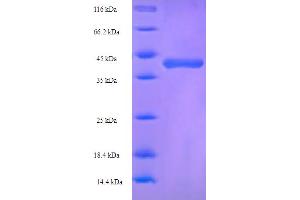 SDS-PAGE (SDS) image for Glutathione S-Transferase alpha 1 (GSTA1) (AA 2-222) protein (His-SUMO Tag) (ABIN5709615)