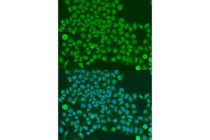 Immunofluorescence analysis of U2OS cells using TARDBP antibody. (TARDBP anticorps  (AA 1-100))