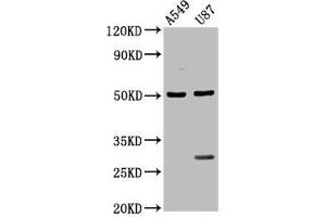 Western Blot Positive WB detected in: A549 whole cell lysate, U87 whole cell lysate All lanes: LANCL2 antibody at 3. (LANCL2 anticorps  (AA 2-106))