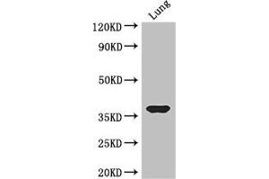 HOXD9 Antikörper  (AA 38-276)