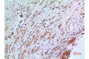 Immunohistochemistry (IHC) analysis of paraffin-embedded Human Brain, antibody was diluted at 1:100.