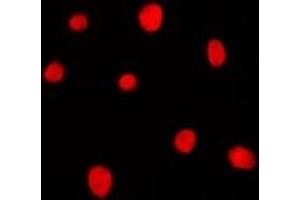 Immunofluorescent analysis of MRG15 staining in K562 cells. (MORF4L1 anticorps)