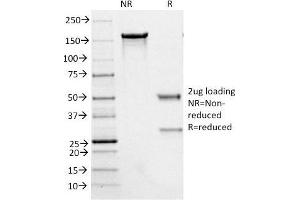 SDS-PAGE Analysis Purified Neurofilament Mouse Monoclonal Antibody (NE14).