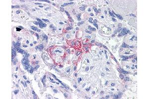 Anti-BUB1B / BubR1 antibody IHC of human placenta. (BUB1B anticorps  (AA 1-130))