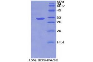 SDS-PAGE analysis of Mouse TNIP2 Protein. (TNIP2 Protéine)