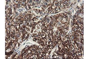 Image no. 15 for anti-Src-like-adaptor 2 (SLA2) antibody (ABIN1500949) (SLAP2 anticorps)