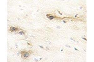 IHC analysis of FFPE human brain tissue stained with MARK1 antibody