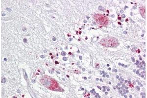 Anti-C12orf5 / TIGAR antibody IHC staining of human brain, cerebellum. (TIGAR anticorps  (AA 140-190))
