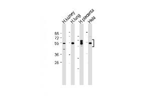 All lanes : Anti-SGK (Ser78) Antibody at 1:2000 dilution Lane 1: Human kidney lysate Lane 2: Human lung lysate Lane 3: Human placenta lysate Lane 4: Hela whole cell lysate Lysates/proteins at 20 μg per lane.