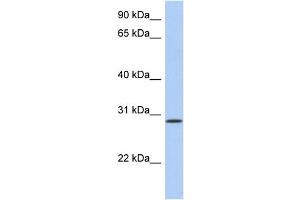 WB Suggested Anti-HAVCR2 Antibody Titration:  0. (TIM3 anticorps  (N-Term))
