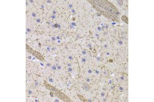 Immunohistochemistry of paraffin-embedded Mouse brain using CNP antibody at dilution of 1:100 (x400 lens). (Cnpase anticorps)