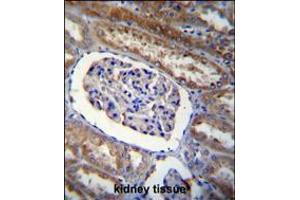 ARL8 Antibody immunohistochemistry analysis in formalin fixed and paraffin embedded human kidney tissue followed by peroxidase conjugation of the secondary antibody and DAB staining. (ARL5B anticorps  (C-Term))