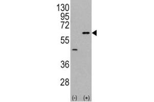 Western blot analysis of AKT3 antibody and 293 cell lysate (2 ug/lane) either nontransfected (Lane 1) or transiently transfected with the AKT3 gene (2).