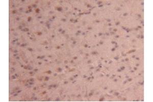 Detection of CPB2 in Mouse Brain Tissue using Polyclonal Antibody to Carboxypeptidase B2 (CPB2)