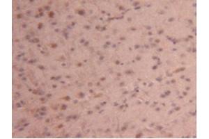 Detection of CPB2 in Mouse Brain Tissue using Polyclonal Antibody to Carboxypeptidase B2 (CPB2) (CPB2 anticorps  (AA 187-327))