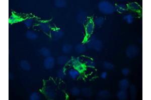 anti-B and T Lymphocyte Associated (BTLA) antibody