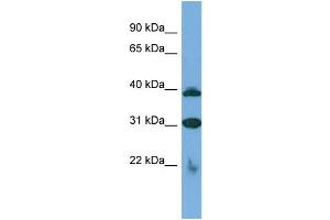 Host:  Rabbit  Target Name:  SLC1A6  Sample Type:  Jurkat Whole cell lysates  Antibody Dilution:  1.