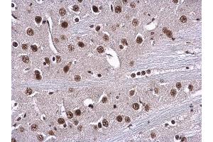 IHC-P Image RPA70 antibody [C1C3] detects RPA1 protein at nucleus in mouse brain by immunohistochemical analysis. (RPA1 anticorps  (C-Term))