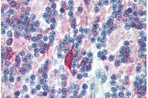 Human Brain, Cerebellum (formalin-fixed, paraffin-embedded) stained with MAP2 antibody ABIN462127 followed by biotinylated anti-mouse IgG secondary antibody ABIN481714, alkaline phosphatase-streptavidin and chromogen.