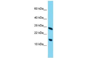 Host: Rabbit Target Name: C11orf52 Sample Type: HepG2 Whole Cell lysates Antibody Dilution: 1. (C11ORF52 anticorps  (C-Term))