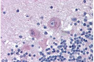 Human Brain, Cerebellum (formalin-fixed, paraffin-embedded) stained with SNX26 antibody ABIN290200 at 2. (SNX26 anticorps  (AA 1113-1126))