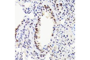 Immunohistochemistry of paraffin-embedded rat lung using EWSR1 Rabbit mAb (ABIN7267053) at dilution of 1:100 (40x lens). (EWSR1 anticorps)