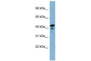 UEVLD antibody used at 1 ug/ml to detect target protein. (UEVLD anticorps  (N-Term))