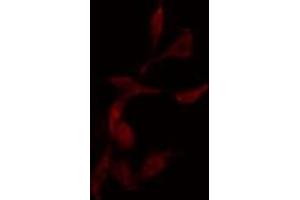 ABIN6275037 staining  HepG2 cells by IF/ICC. (NCAPG anticorps  (C-Term))