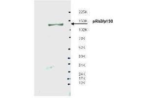 Western blot using  affinity purified anti-Spa310 antibody shows detection of endogenous pRb2/p130 protein in whole LNCaP cell extracts. (p130 anticorps)
