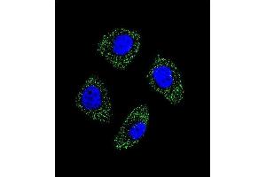 Confocal immunofluorescent analysis of EDN1 Antibody (Center)  with A549 cell followed by Alexa Fluor 488-conjugated goat anti-rabbit lgG (green). (Endothelin 1 anticorps  (Center))