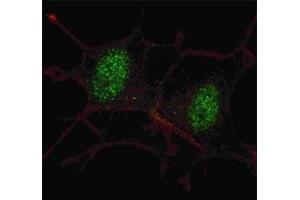 Fluorescent confocal image of SY5Y cells stained with SMAD2 antibody at 1:100.