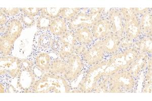Detection of SPHK1 in Human Kidney Tissue using Polyclonal Antibody to Sphingosine Kinase 1 (SPHK1) (SPHK1 anticorps  (AA 148-398))