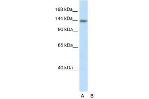 WB Suggested Anti-TIMELESS Antibody Titration:  2. (TIMELESS anticorps  (C-Term))