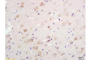 Formalin-fixed and paraffin embedded rat brain tissue labeled with Anti S-100/S100A1 Polyclonal Antibody, Unconjugated (ABIN728983) at 1:200 followed by conjugation to the secondary antibody and DAB staining. (S100A1 anticorps)