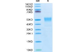 Biotinylated Human TROP-2 on Tris-Bis PAGE under reduced condition. (TACSTD2 Protein (AA 27-274) (His-Avi Tag,Biotin))