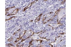 ABIN6268712 at 1/100 staining human lung tissues sections by IHC-P. (Aquaporin 4 anticorps  (Internal Region))