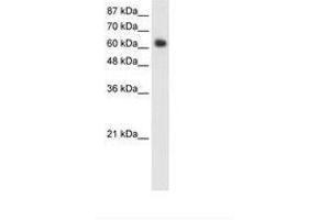 Image no. 1 for anti-Forkhead Box G1 (FOXG1) (C-Term) antibody (ABIN202649)