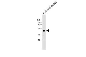 Anti-WIF1 Antibody (Human C-term) at 1:2000 dilution + Human skeletal muscle lysate Lysates/proteins at 20 μg per lane. (WIF1 anticorps  (C-Term))