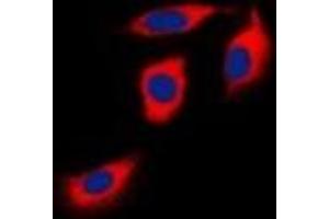 Immunofluorescent analysis of EPHA1 staining in Hela cells. (EPHA1 anticorps)