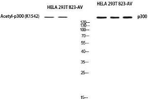Western Blot (WB) analysis of HeLa 293T 823-AV using EP300 antibody. (p300 anticorps)