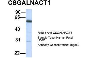 Host:  Rabbit  Target Name:  CSGALNACT1  Sample Type:  Human Fetal Heart  Antibody Dilution:  1. (CSGALNACT1 anticorps  (C-Term))
