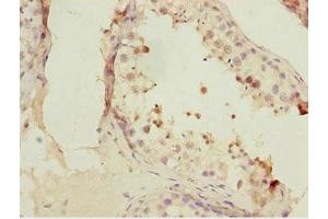 Immunohistochemistry of paraffin-embedded human testis tissue using ABIN7153074 at dilution of 1:100