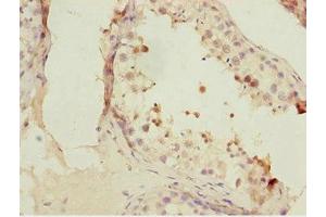 Immunohistochemistry of paraffin-embedded human testis tissue using ABIN7153074 at dilution of 1:100 (FOXN2 anticorps  (AA 172-431))