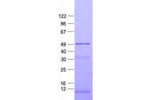 Validation with Western Blot