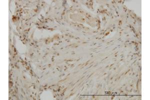 Immunoperoxidase of monoclonal antibody to DLX2 on formalin-fixed paraffin-embedded human ovary. (DLX2 anticorps  (AA 1-110))
