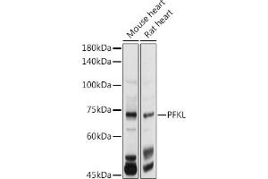 Western blot analysis of extracts of various cell lines, using PFKL antibody (ABIN7269308) at 1:1000 dilution. (PFKL anticorps  (AA 700-780))