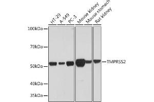 Western blot analysis of extracts of various cell lines, using TMPRSS2 Rabbit mAb (ABIN7270946) at 1:1000 dilution.