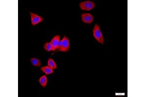 HeLa cells were stained with AQP1 Polyclonal Antibody, Unconjugated at 1:500 in PBS and incubated for two hours at 37°C followed by Goat Anti-Rabbit IgG (H+L) Cy3 conjugated secondary antibody. (Aquaporin 1 anticorps  (AA 181-269))