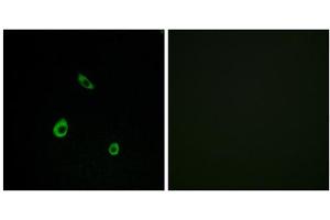 Immunofluorescence analysis of LOVO cells, using MAPK15 antibody.